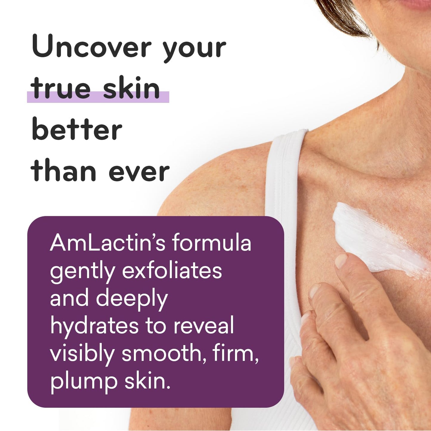 AmLactin Crepe Firming Cream - 12 oz Body Cream with 15% Lactic Acid