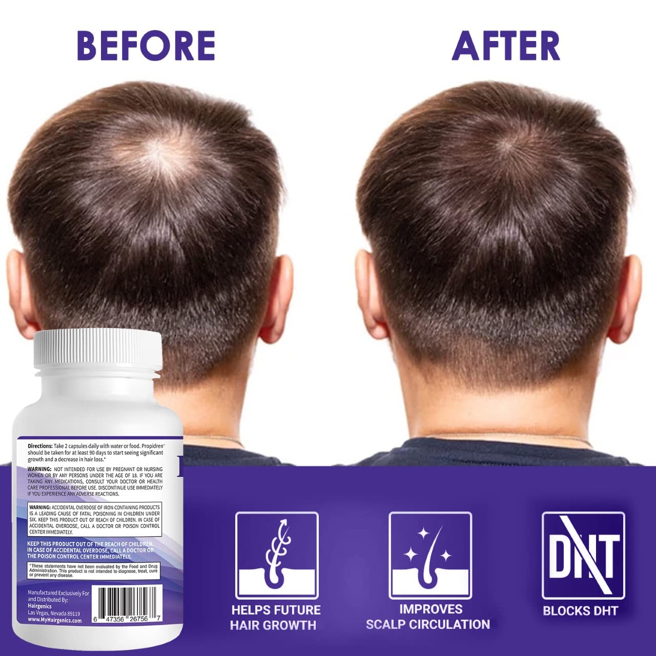 Propidren by HairGenics - DHT Blocker & Hair Growth 60 Capsules