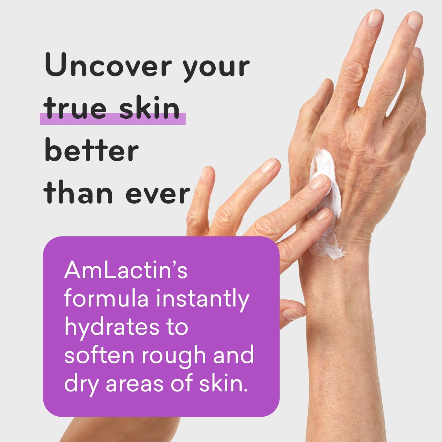 AmLactin Ultra Smoothing - 4.9 oz Body & Hand Cream with 15% Lactic Acid