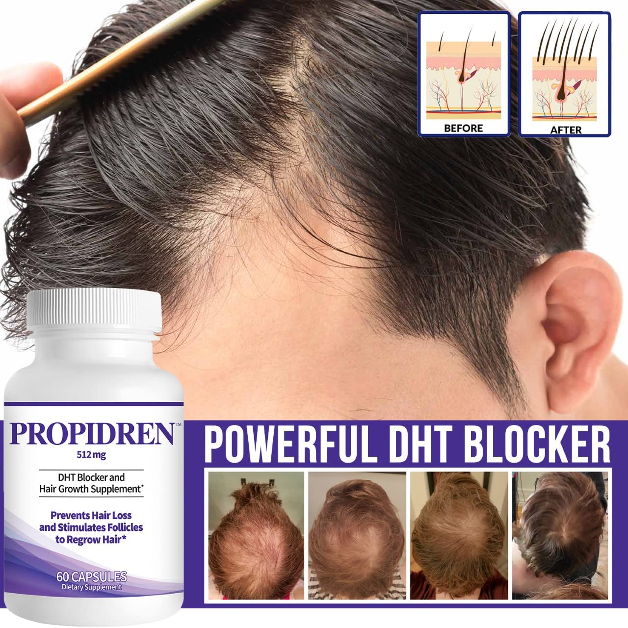 Propidren by HairGenics - DHT Blocker & Hair Growth 60 Capsules