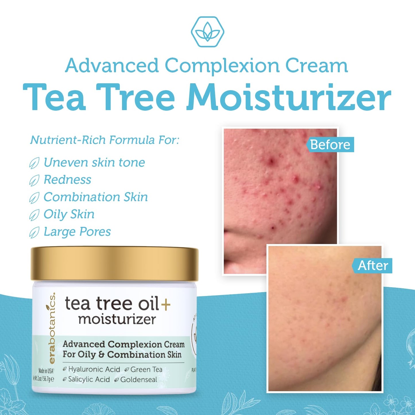 Era Organics Tea Tree Cream Face Moisturizer for Oily Skin