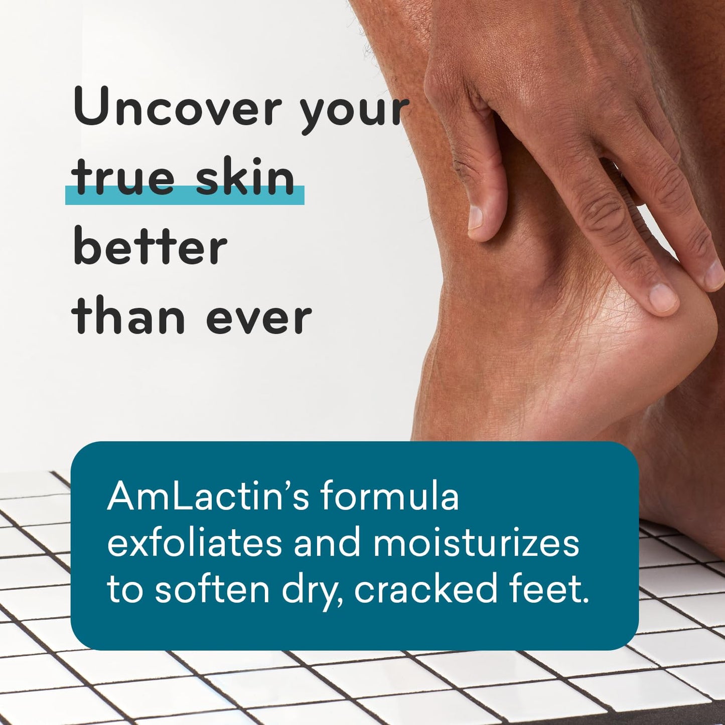 AmLactin Foot Repair Cream - 3 oz Foot Cream for Dry Cracked Heels with 15% Lactic Acid