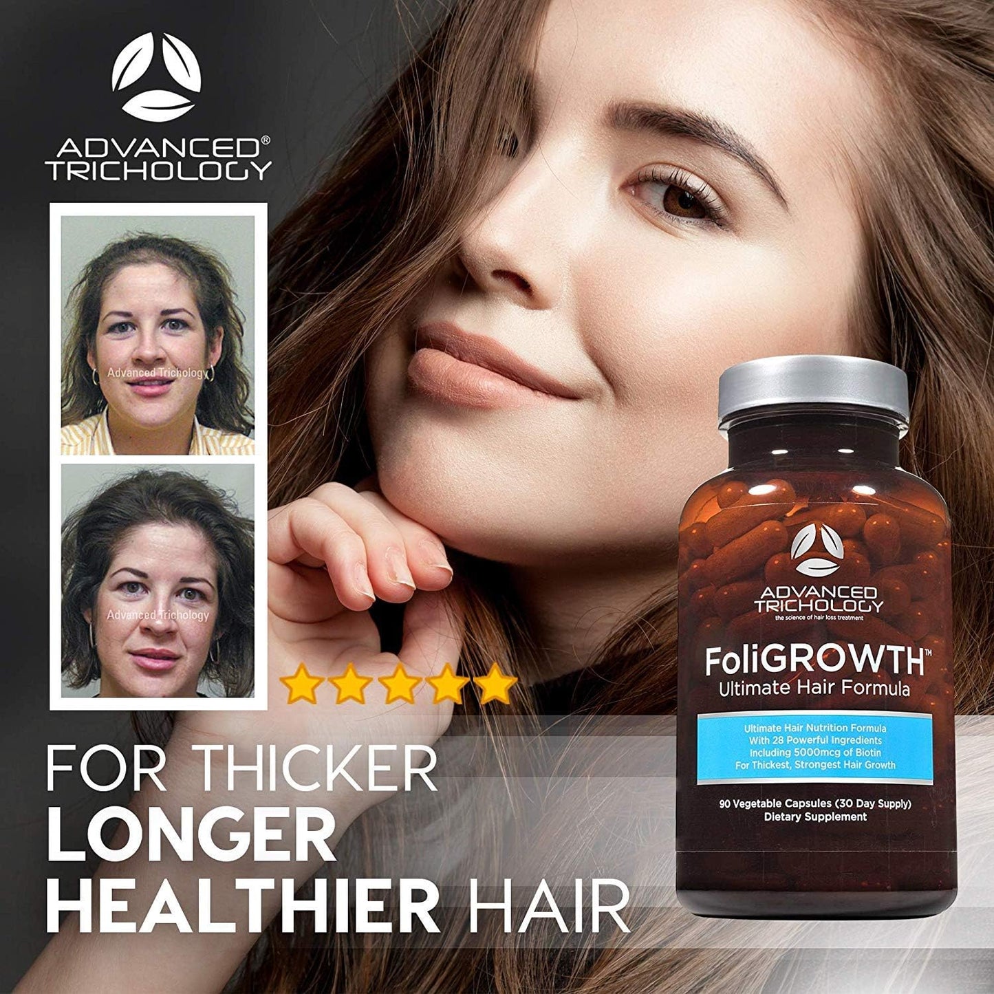 FoliGROWTH™ Hair Growth Supplement for Thicker Fuller Hair