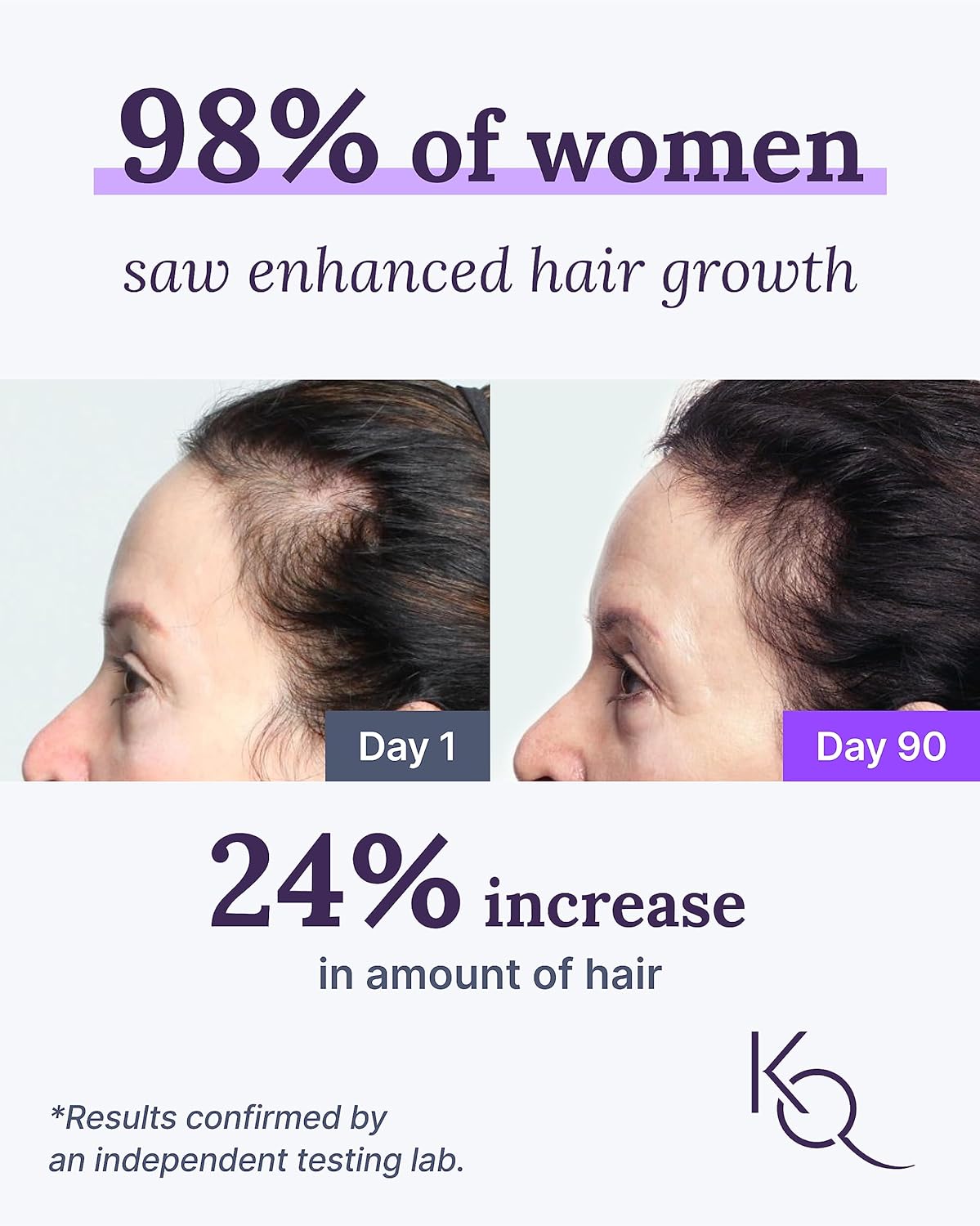 Keranique Hair & Scalp Supplements - Promote Strength and Growth