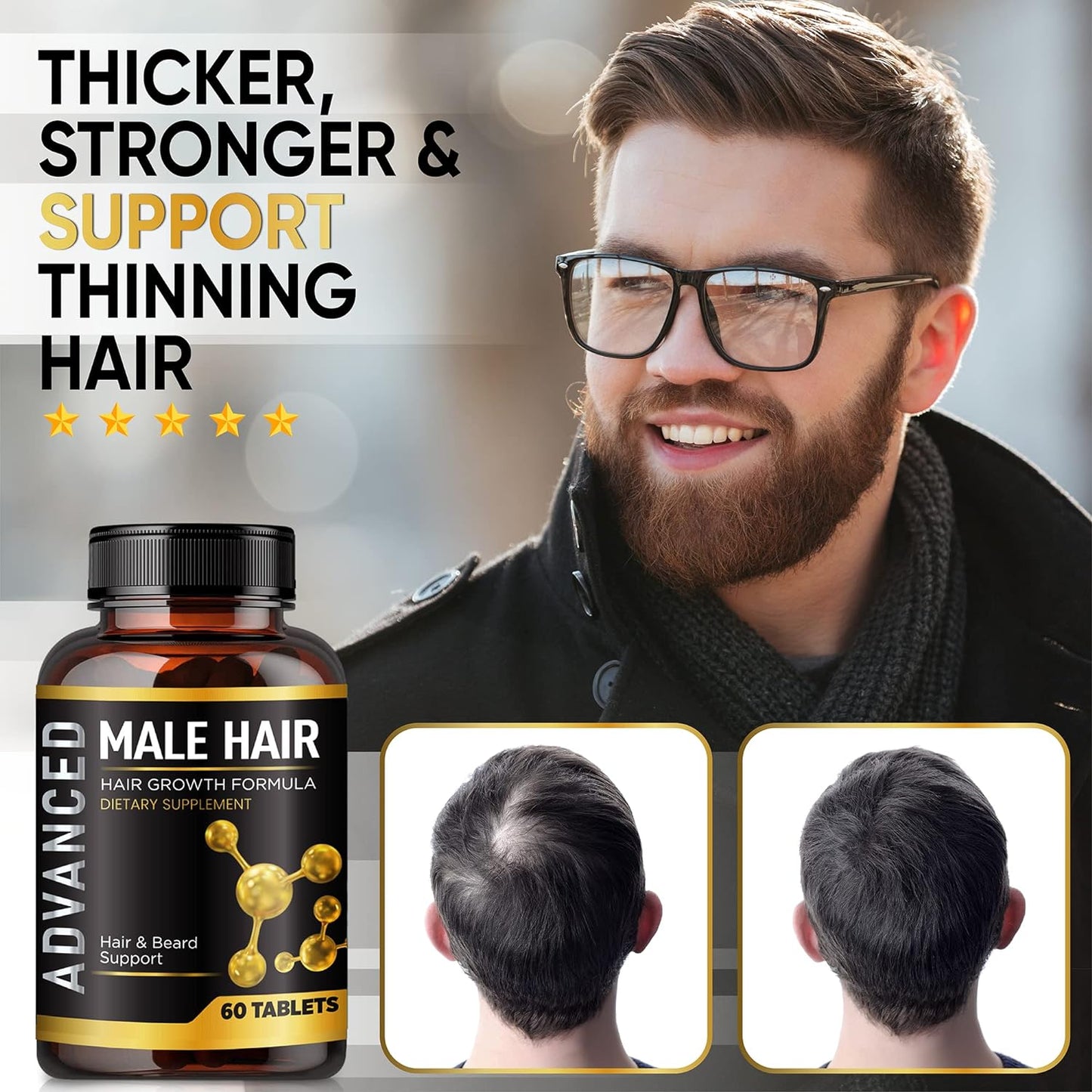 Hair Growth Vitamins For Men-Anti Hair Loss Support Vitamins Pills & Dht Blocker