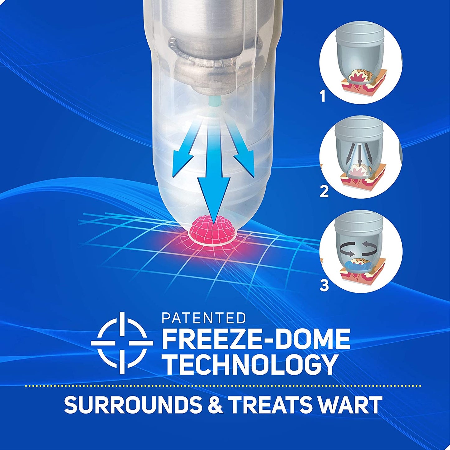 Care Science Wart Remover Freeze, 8 Applications