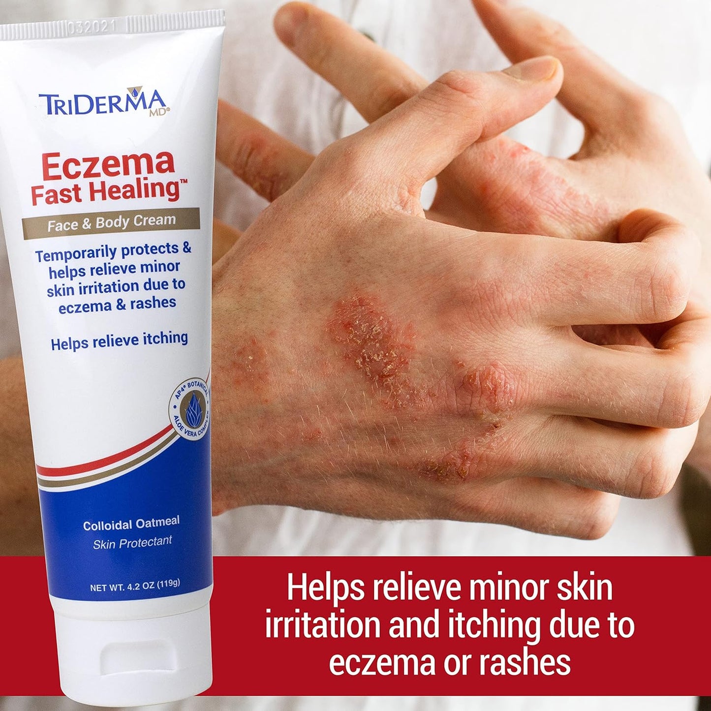 Triderma Eczema Fast Healing Cream, 4.2 Ounce